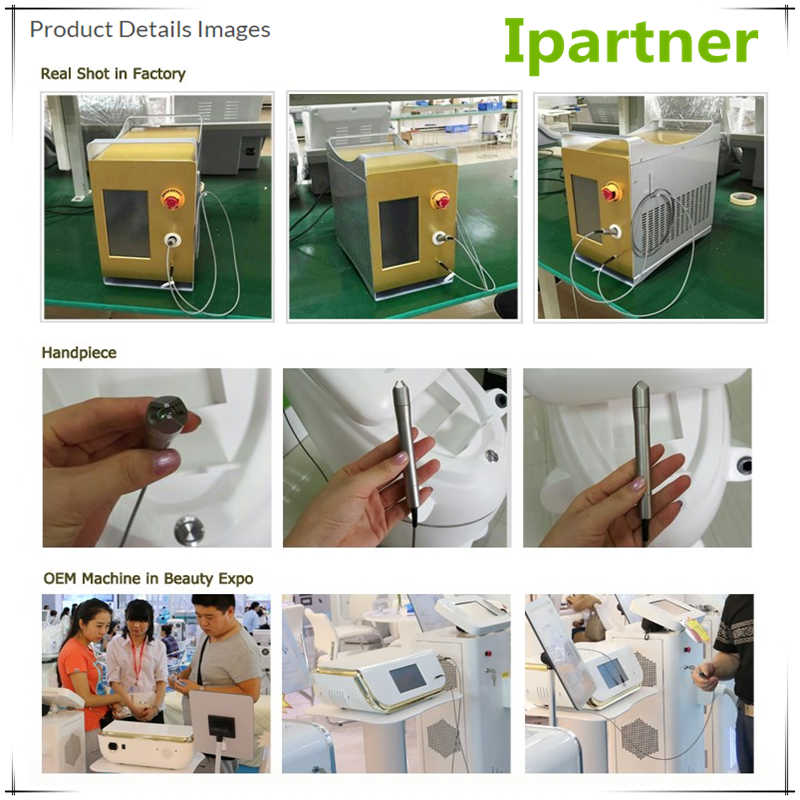 Il laser a diodi Ipartner LS980 riduce il sistema di arrossamento