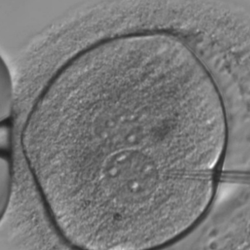 scienziato cinese crediti mondo \ è il primo gene modificato i bambini, con la negazione di ospedale e indignazione internazionale