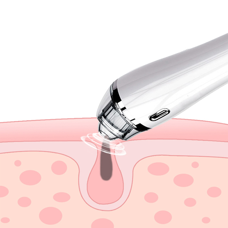 Blackhead Remover Vacuum - Strumento di estrazione dell'acne Comedo per aspirazione facciale elettrico per pulizia dei pori per donne e uomini