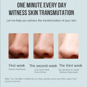 Estrattore Estrattore Acne Rimozione di Acne Blackhead Remover Aspirapolvere Aspira Beauty Machine Cleaner Pore