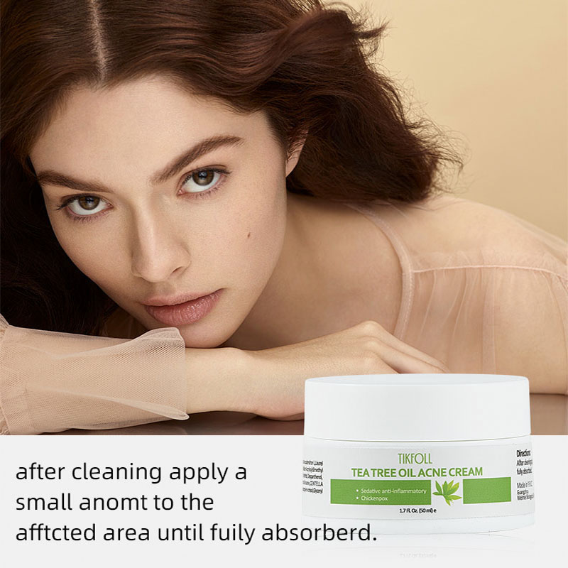 Crema acne dell'olio dell'albero del tè