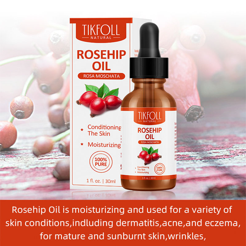 Olio di rosa canina